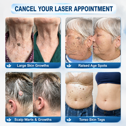 👩‍⚕️💯 𝐎𝐟𝐟𝐢𝐜𝐢𝐚𝐥 𝐒𝐭𝐨𝐫𝐞 | 𝑵𝐞𝒌𝐢𝐬𝐬® 🌿 𝐁𝐨𝐭𝐚𝐧𝐢𝐜𝐚𝐥 𝐌𝐢𝐜𝐫𝐨𝐧𝐞𝐞𝐝𝐥𝐞 𝐇𝐲𝐝𝐫𝐨𝐜𝐨𝐥𝐥𝐨𝐢𝐝 𝐏𝐚𝐭𝐜𝐡 (𝐅𝐨𝐫 𝐒𝐤𝐢𝐧 𝐓𝐚𝐠𝐬, 𝐒𝐦𝐚𝐥𝐥 𝐒𝐤𝐢𝐧 𝐆𝐫𝐨𝐰𝐭𝐡𝐬, 𝐖𝐚𝐫𝐭𝐬, 𝐌𝐨𝐥𝐞𝐬, 𝐀𝐠𝐞 𝐒𝐩𝐨𝐭𝐬 & 𝐏𝐢𝐠𝐦𝐞𝐧𝐭𝐚𝐭𝐢𝐨𝐧 𝐂𝐨𝐧𝐜𝐞𝐫𝐧𝐬)