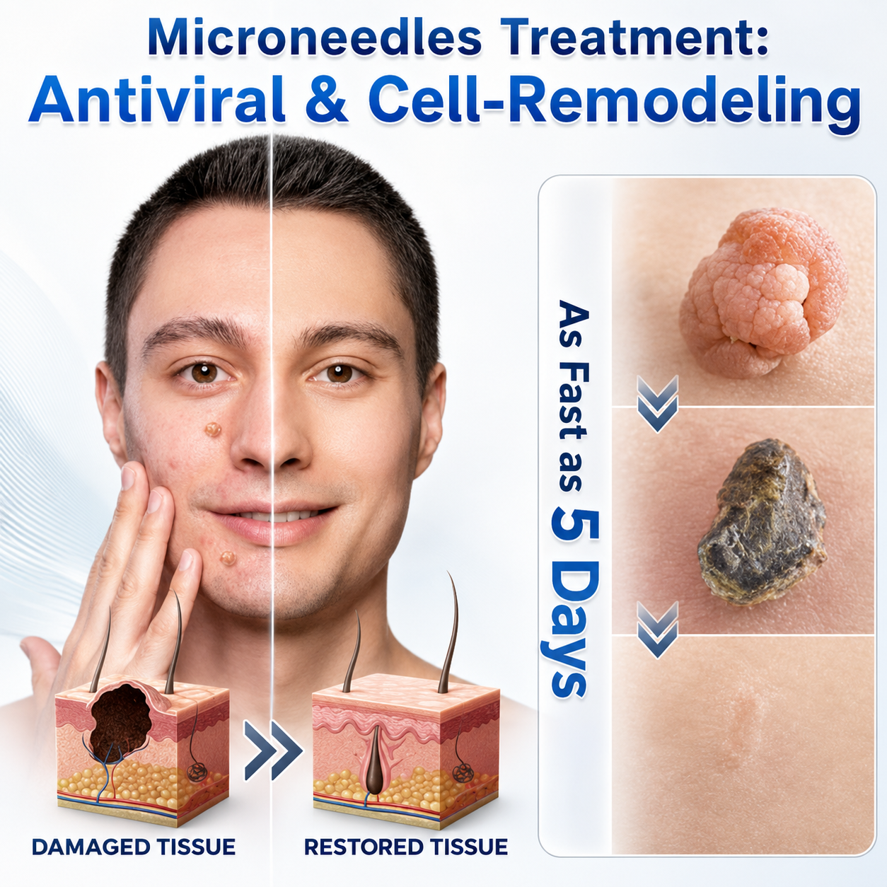 👩‍⚕️🥇 𝐎𝐟𝐟𝐢𝐜𝐢𝐚𝐥 𝐒𝐭𝐨𝐫𝐞 | 𝑵𝐞𝒌𝐢𝐬𝐬® 🌿 𝐁𝐨𝐭𝐚𝐧𝐢𝐜𝐚𝐥 𝐌𝐢𝐜𝐫𝐨𝐧𝐞𝐞𝐝𝐥𝐞 𝐇𝐲𝐝𝐫𝐨𝐜𝐨𝐥𝐥𝐨𝐢𝐝 𝐏𝐚𝐭𝐜𝐡 (𝐅𝐨𝐫 𝐒𝐤𝐢𝐧 𝐓𝐚𝐠𝐬, 𝐒𝐦𝐚𝐥𝐥 𝐒𝐤𝐢𝐧 𝐆𝐫𝐨𝐰𝐭𝐡𝐬, 𝐖𝐚𝐫𝐭𝐬, 𝐌𝐨𝐥𝐞𝐬, 𝐀𝐠𝐞 𝐒𝐩𝐨𝐭𝐬 & 𝐏𝐢𝐠𝐦𝐞𝐧𝐭𝐚𝐭𝐢𝐨𝐧 𝐂𝐨𝐧𝐜𝐞𝐫𝐧𝐬)